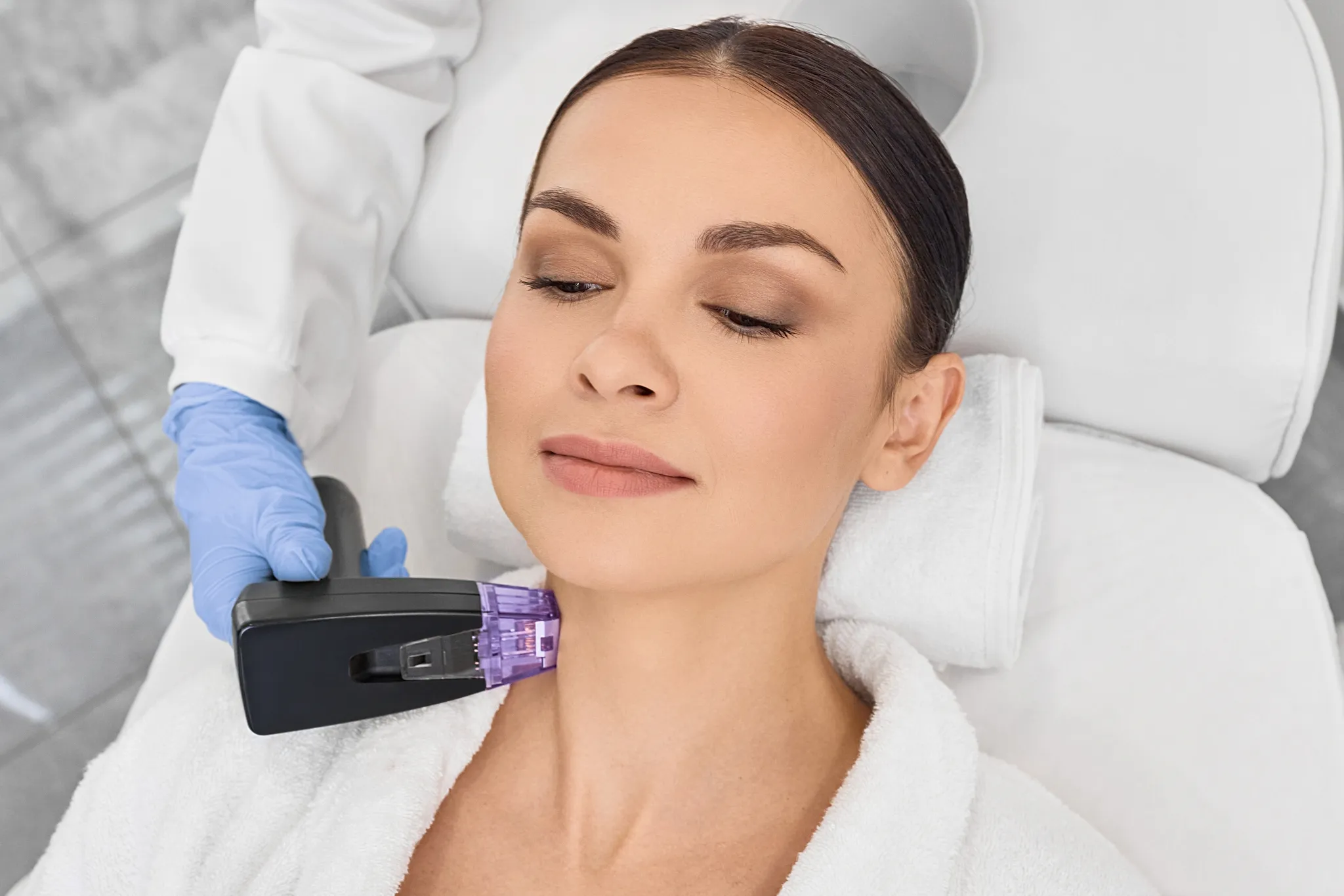 Procédure Morpheus8 avancée pour le remodelage profond du visage et du cou
